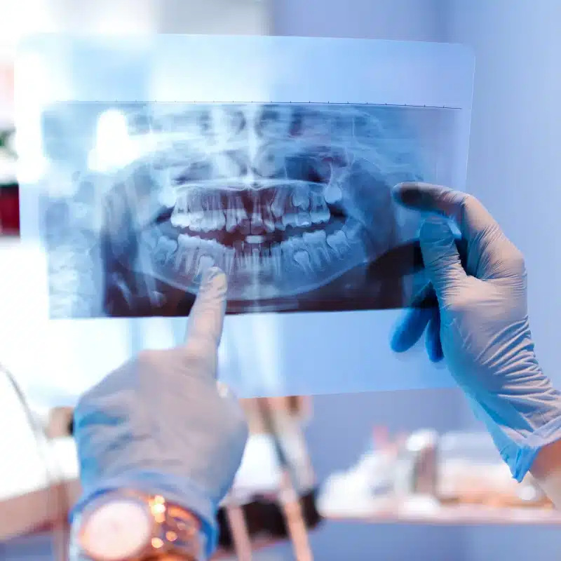 Dentist examining dental X-ray film for oral surgery in fernley