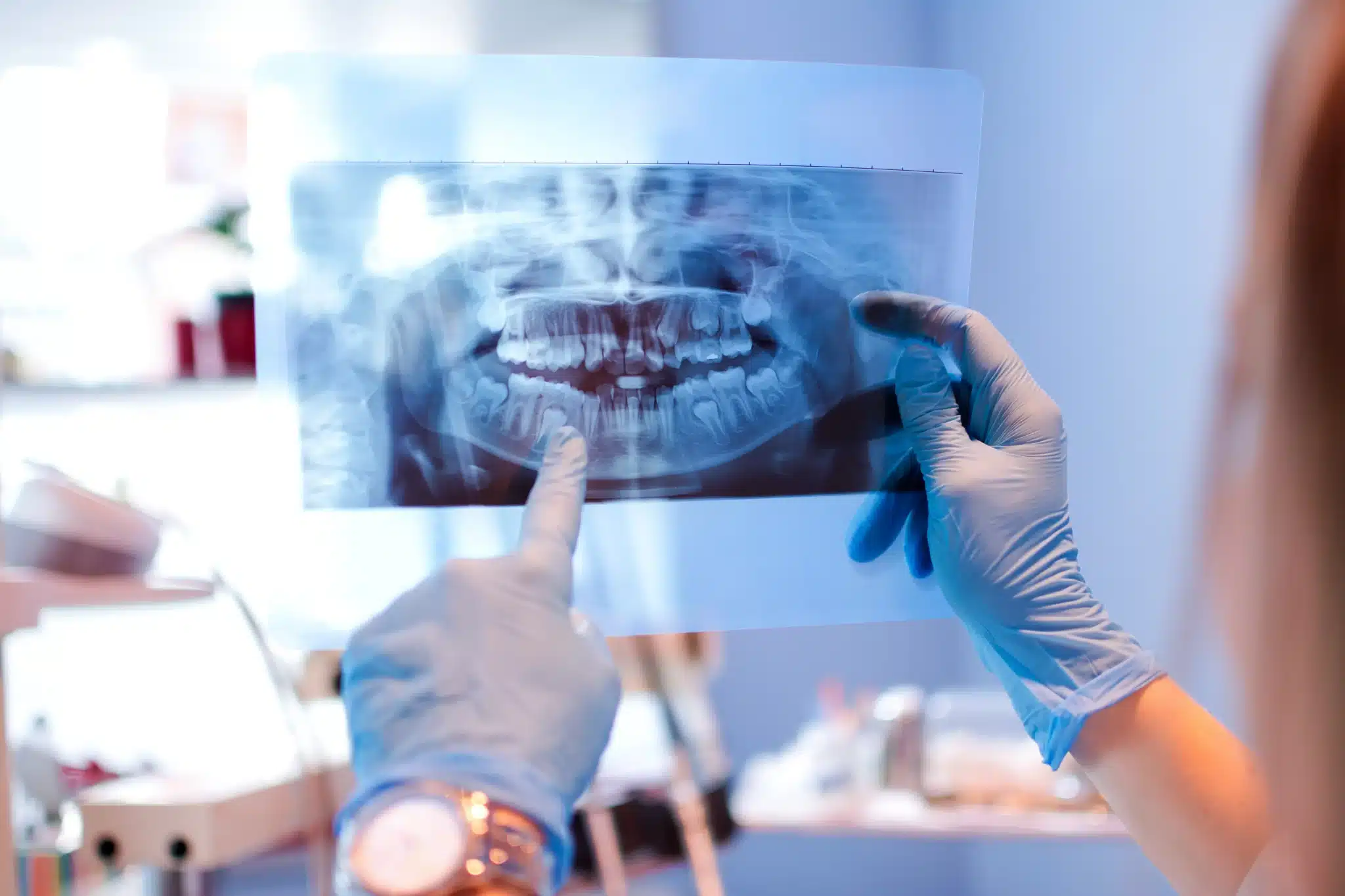 Dentist examining dental X-ray film for oral surgery in fernley